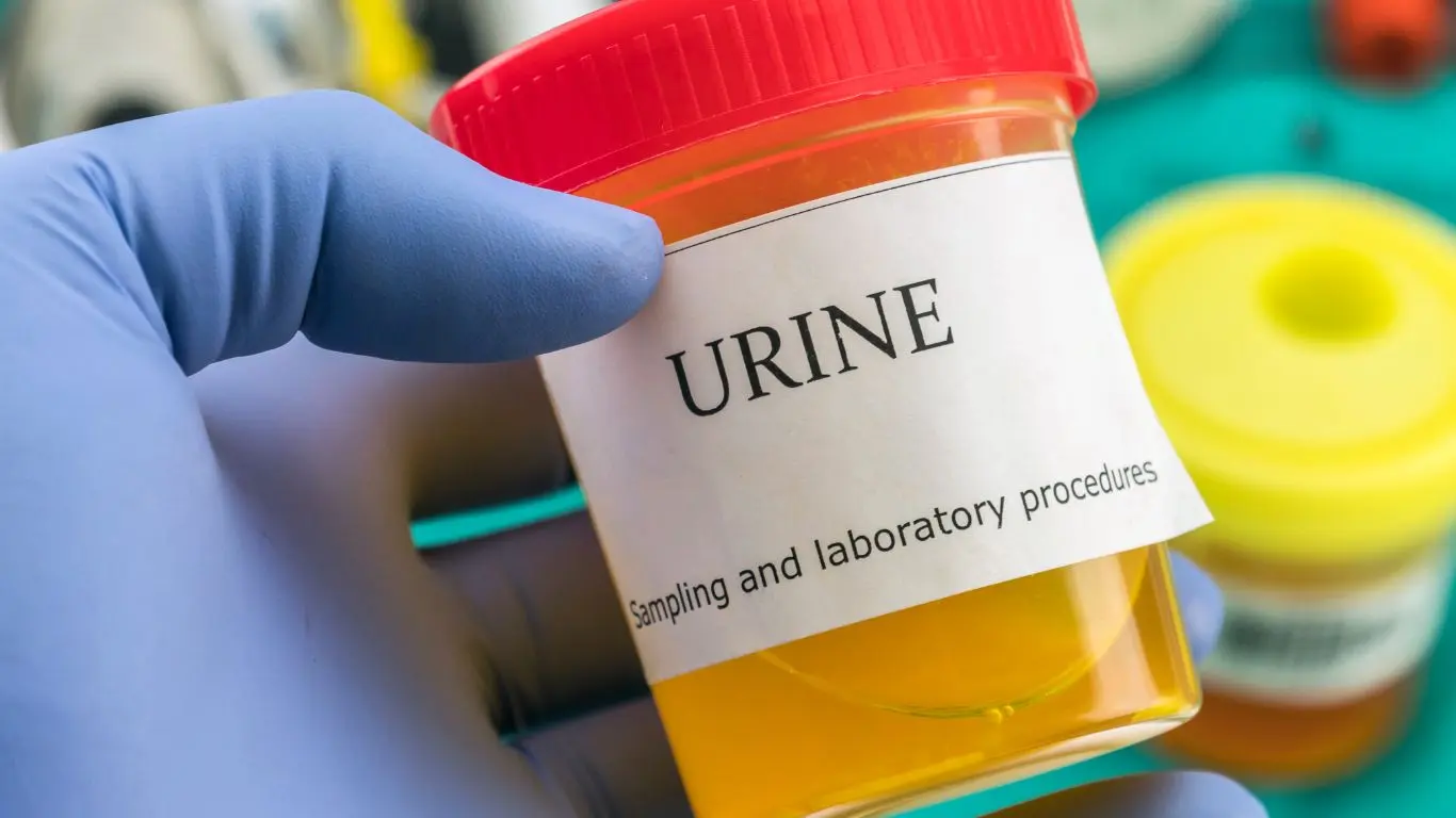 urine drug screening cups